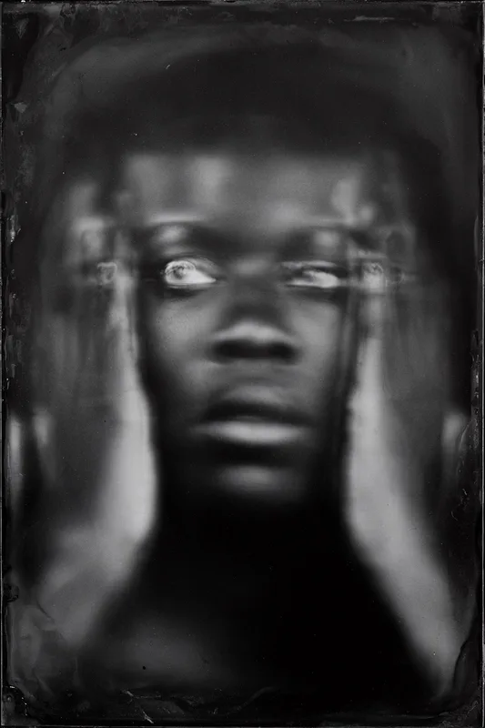 A Black person, likely male, pressing both hands against the sides of their face, eyes rolled upward or wide — the white